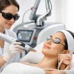 Fotona Pico Laser untuk Apa dan Siapa Sesuai?