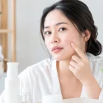 Cara Hilangkan Jerawat Hormon Dewasa dengan Selamat