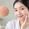 Rawatan Terbaik untuk Pori Besar yang Berkesan